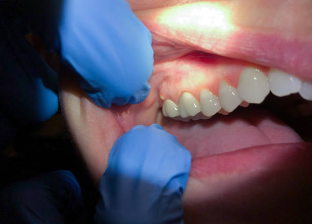 Best Same-Day Emergency Dentist in Redstone Arsen, AL