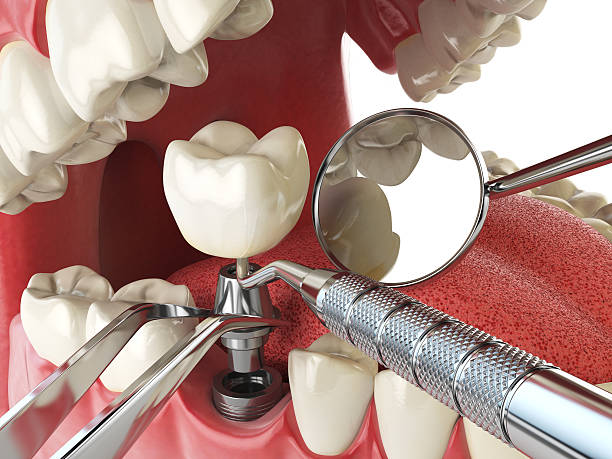Best Emergency Dental Care for Trauma or Injury in Redstone Arsen, AL